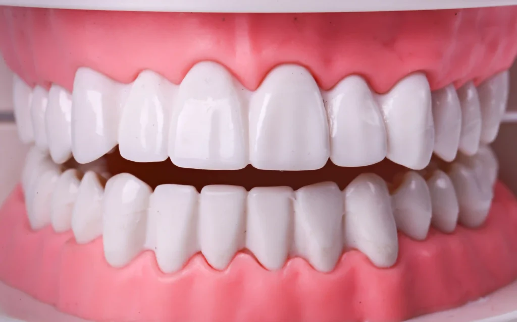 Özel Sinan Çavuş Silivri Diş Kliniği'nde uygulanan alt ve üst çene All on 6 implant tedavisi. Silivri All On Six.