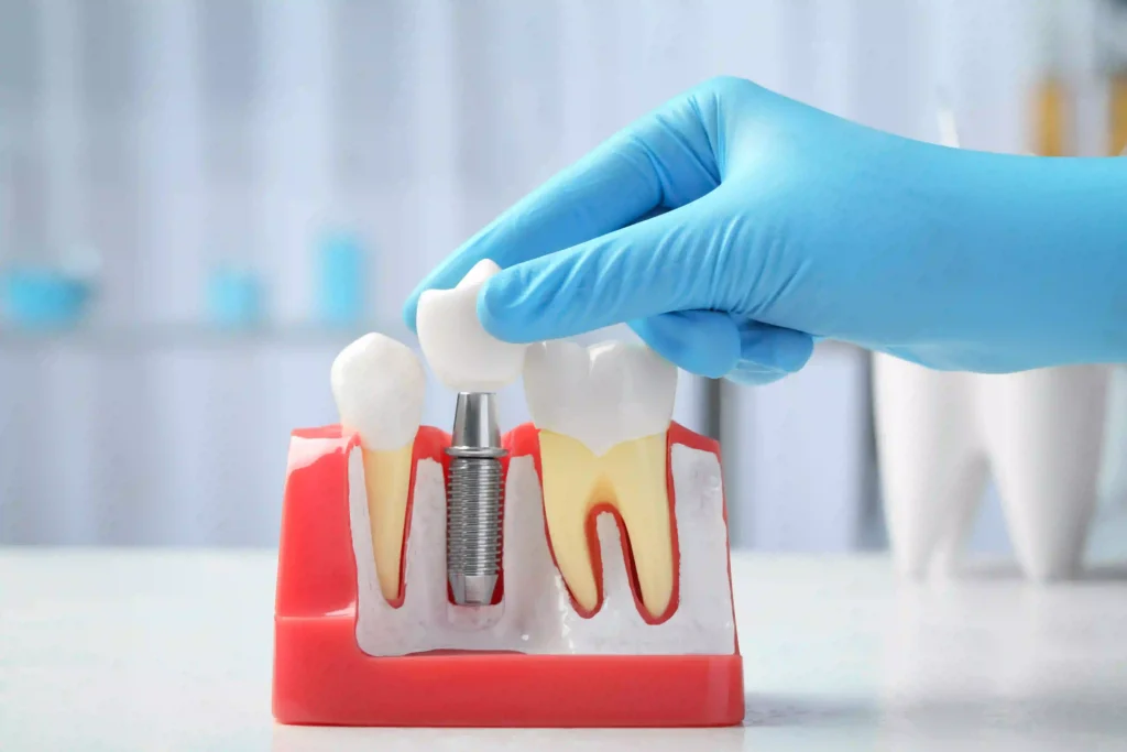 Silivri Özel Sinan Çavuş Diş Kliniği'nde uygulanan modern dental implant tedavileri ve güncel teknolojik altyapı. Silivri Dental İmplant