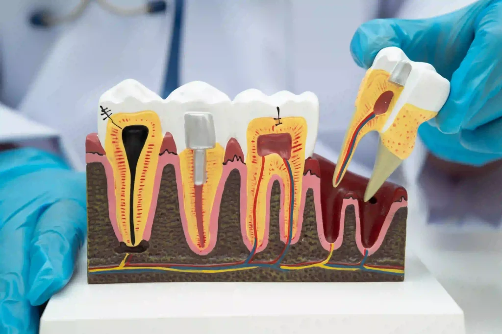 Silivri Kemik Grefti - Silivri Özel Sinan Çavuş Diş Kliniği'nde implant tedavisi öncesi çene kemiği hacmini artırmak amacıyla uygulanan kemik grefti (kemik tozu) işlemi ve planlama süreci.